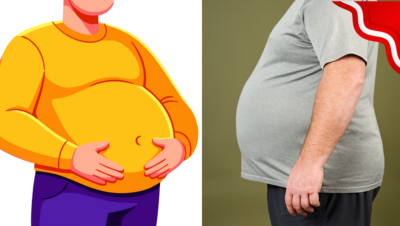 hombre se pone panzón